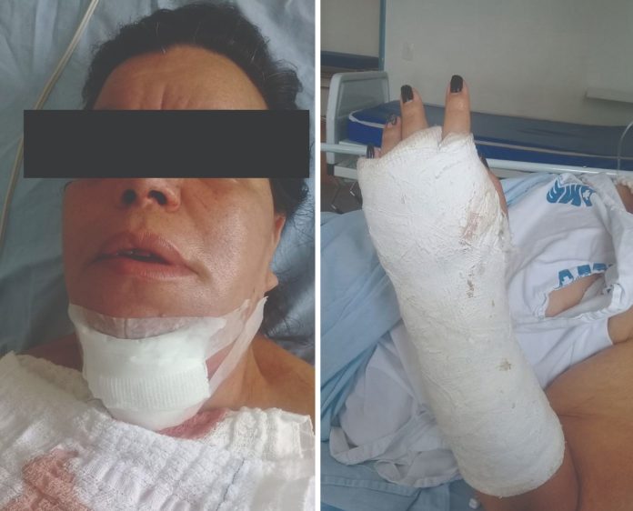 Agressão: mulher precisou passar por cirurgia e por placas no maxilar. Vítima ainda teve braço fraturado depois de levar diversos chutes (Divulgação/Notícias Policiais)